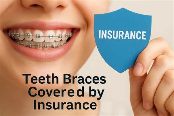 Is braces covered by health insurance?